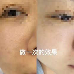 -SKIN79皮肤管理中心