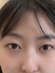 体验前-西安伊美尔医疗美容医院