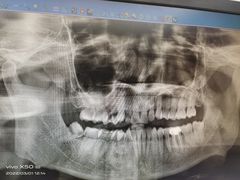 -浙江大学医学院附属第一医院(庆春院区)