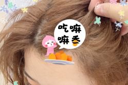 -大麦微针植发全国连锁