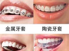 -优伢仕口腔(汽车西站店)