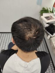 -唐风采假发补发定制