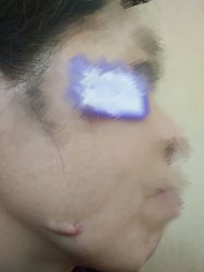 -成都军建医院·疤痕诊疗中心