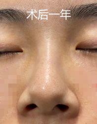 -八大处整形