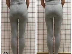 -修申骨雕小颜脊柱骨盆管理产后修复