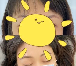 -Doris多里斯半永久纹眉·SMP纹发·发际线