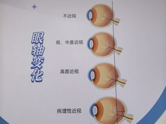 -昆明爱尔眼科医院