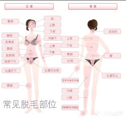 -MUSES专业脱毛比基尼サロン日式连锁