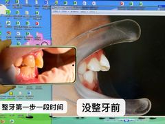 -杭州口腔医院(城西院区)