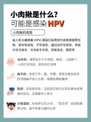 -清疣美疣·痣·斑净肤中心