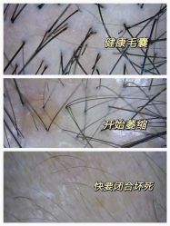 -诗碧曼养发