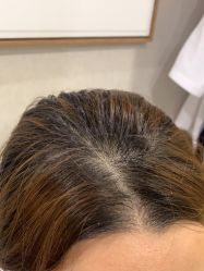 体验前-熙朵美学植发·连锁品牌