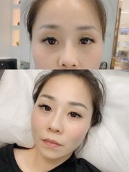 -MIVI半永久纹眉绣眉