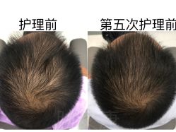 -天其美科学美肤·生发健康管理