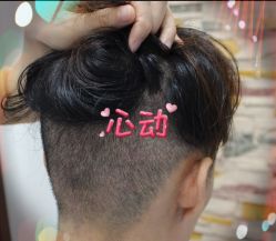 -大麦微针植发全国连锁