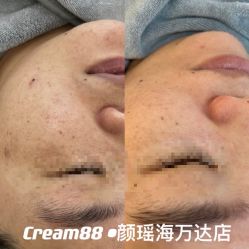 -Cream88颜皮肤管理中心