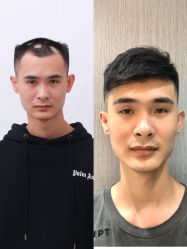 -发饰美男士增发补发假发定制店