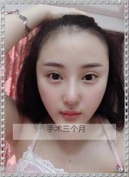 -大麦微针植发全国连锁