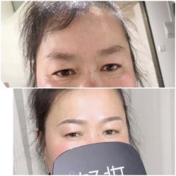 -Doris多里斯半永久纹眉·SMP纹发·发际线