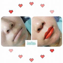 -YooMee优美智能科技美肤机构