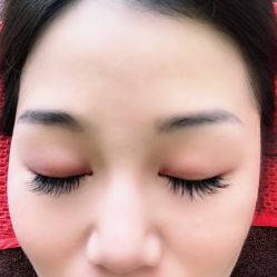 -松和日式美容整骨