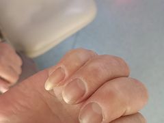 -新甲连锁灰指甲·甲沟炎·鸡眼(黑龙江路店)