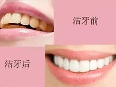 -团圆口腔·种植中心(锦江院区)
