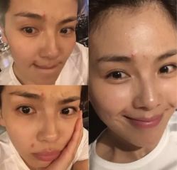 -苗方清颜痘肌研究所