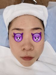 体验后-上海首尔丽格医疗美容医院