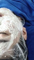 -蕾特恩专业祛痘