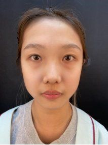 -北京米扬丽格医疗美容·联合丽格鼻整形中心