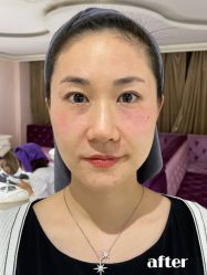 -广州美莱医疗美容医院