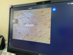 -悟空祛痘·诺奖技术专业店