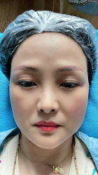 -一美医疗美容