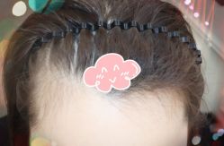 -大麦微针植发全国连锁