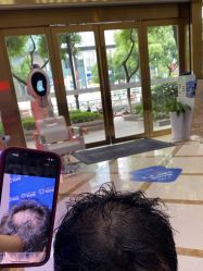 -碧莲盛·不剃发植发