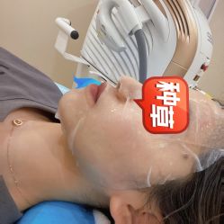 体验后-贞禾医美·连锁