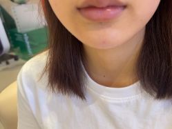 -Yestar 嘉兴艺星医疗美容医院