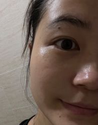 体验后-澳尔颜选医疗美容