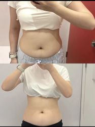 -Fundi张玉珊修身堂·indiba·BTL科技瘦身