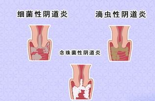 -邢台妇产医院