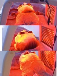 -美肤盾祛痘·问题肌头疗管理中心