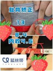 -蓝丝带产后恢复中心(都江堰店)