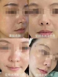 -LUNA皮相美·骨相美高级美感