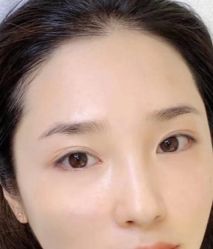 -莲姿娜半永久纹眉皮肤管理