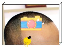 -大麦微针植发全国连锁