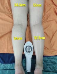 -苗塑堂减肥·艾灸