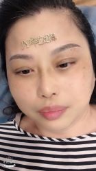 点击看大图 -郡艺医疗美容·微整·眼鼻吸脂