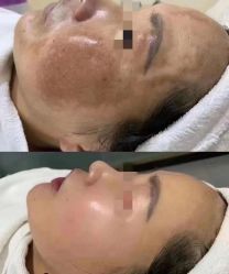 -+MS卓美丝专业祛痘·皮肤管理中心