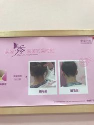-晶奕空间专业脱毛连锁机构